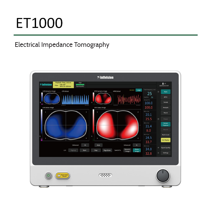 Infivision-ET1000-Electrical-Impedance-Tomography